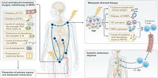 Although the percentage of cases in men is much lower than in women, male breast cancer accounts for a por. Cytoreductive Treatment Strategies For De Novo Metastatic Prostate Cancer Nature Reviews Clinical Oncology