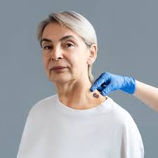 Biopsia de piel en Guadalajara