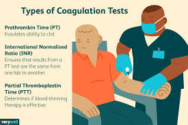 Requestatest.com has been visited by 10k+ users in the past month What Do Your Pt Ptt And Inr Results Mean
