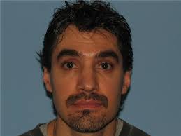 Rhinoplasty Before and After Photos by Paul Vanek, MD, FACS; Concord, OH