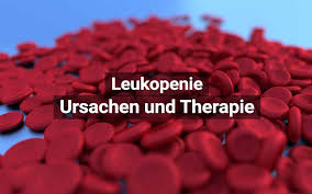 Leukopenie Zu Wenig Weisse Blutkorperchen Leukozyten Praktischarzt