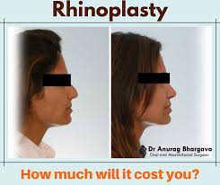 The best approach is to be conservative, and a nose ring could cause distraction during a job interview. Cost Of Rhinoplasty In India It Is Cheaper Than You Think Dr Anurag Bhargava