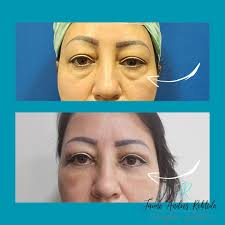 Jaime Andres Robledo Ramirez (@drjaimeandresrobledo) • Instagram photos and  videos