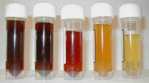 We did not find results for: Warna Urine Dan Tinja Pengaruhi Kesehatan Anda Health Liputan6 Com
