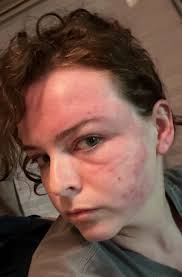 I live in FL and came home from being out of town for a long time. So i  hadn't been able to assess anything from after the hurricanes we got. I get