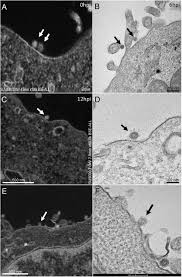 What does an electron look like under a microscope. Frontiers The Strengths Of Scanning Electron Microscopy In Deciphering Sars Cov 2 Infectious Cycle Microbiology