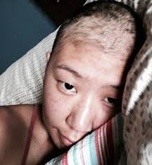 I know how lucky i am. Lily S Story Cervical Cancer Caused By Hpv Minnesota Dept Of Health