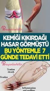 This Image Has Get 0 Repins Author Leonie Schmitt In 2020 Gesundheit Naturheilmittel Gesundheit Und Fitness