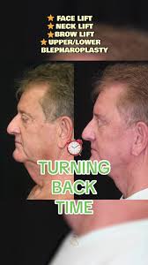 Dr Aj Khalil Beverly Hills Review