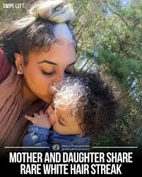 A mother and daughter share a rare and beautiful genetic trait called  poliosis, which causes a lack of pigment in a streak of hair. The condition  runs in their family, making the
