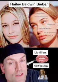 Justin and Hailey Bieber Threaten to Sue a Plastic Surgeon for Saying  Hailey Got Work Done — Scandalous Media