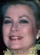 El Antes y Despues de Grace Kelly