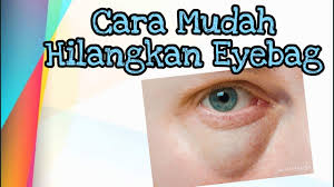 Cara mudah dan cepat hilangkan eyebag bawah mata. Cara Mudah Hilangkan Eyebag Youtube