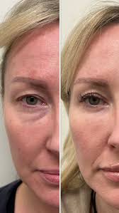 Dr. Babak Maleki, Oculoplastic Surgeon