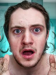 No Shampoo Causes Hair Loss? #noshampoo #hairloss #menshair