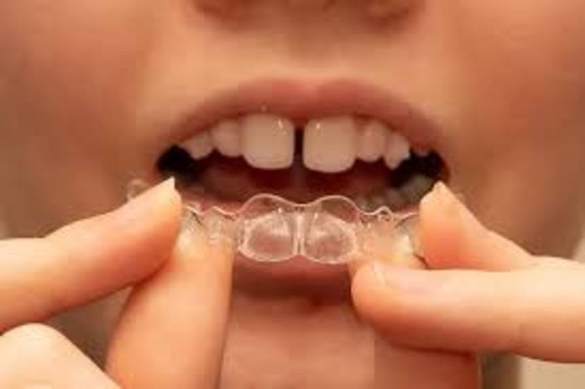 Gaps Filled product image
