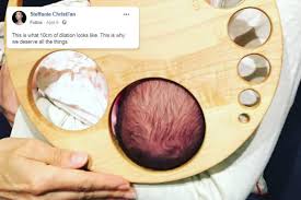 Viral Image Of Babys Head Next To A Wooden Chart