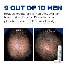 Medications are the most common treatment for hair loss in women. Buy Men S Rogaine 5 Minoxidil Foam For Hair Loss And Hair Regrowth Topical Treatment For Thinning Hair 1 Month Supply Online In Vietnam B005ihe72c