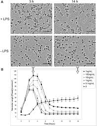 By the age of 14, enzo had already started working, and in the later years, the unfortunate passing of his mother revealed a poorly written will. Frontiers Pathogenic Stress Induces Human Monocyte To Express An Extracellular Web Of Tunneling Nanotubes Immunology