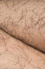 5 ways to deal with random facial hair and it turns out that body hair can go gray just like the hair on your head. Excessive Or Unwanted Hair In Women Causes And Natural Treatments