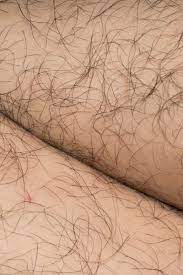 Hormonal imbalances occur when there is too much or too little of a hormone in the bloodstream. Excessive Or Unwanted Hair In Women Causes And Natural Treatments