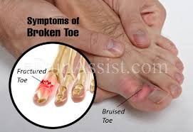 We did not find results for: Broken Toe Or Fractured Toe Treatment Symptoms Recovery Prognosis