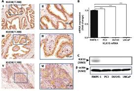This gland helps produce and transport sperm. Nes1 Klk10 Gene Represses Proliferation Enhances Apoptosis And Down Regulates Glucose Metabolism Of Pc3 Prostate Cancer Cells Scientific Reports