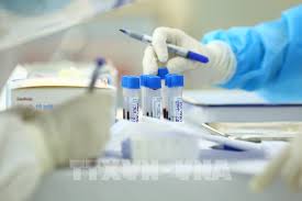 Cảng hàng không quốc tế nội bài. Ha Ná»™i Thiáº¿u 20 000 Bá»™ Test Nhanh Sars Cov 2 Cho NgÆ°á»i Trá»Ÿ Vá» Tá»« Ä'a Náºµng