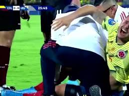 Nicolás benedetti debutó con el deportivo cali el 15 de julio de 2015 a los 80 minutos frente al boyacá chico. Youtube Viral Lesion De Nico Benedetti En La Rodilla Durante El Partido Colombia Vs Uruguay Por El Preolimpico Sub 23 Causa Furor En Redes Sociales Video Futbol Internacional Depor