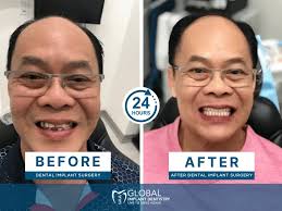 Global Implant Dentistry