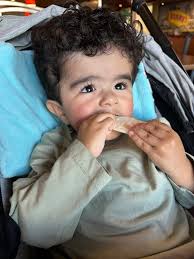 Katie Garcia Hydrocephalus