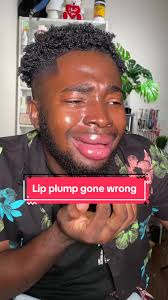 Endo Lip Biting Marth Supreme