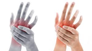 Pochemu Bolyat Kisti Ruk Medrelax Klinika Ortopedii V Harkove