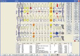 A Usability Evaluation Of Four Commercial Dental Computer