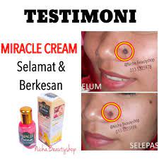 Beberapa orang seringkali mencari tahu kepribadian atau wataknya melalui arti dari sebuah tahi lalat. Miracle Cream Krim Penanggal Tahi Lalat Miracle Cream Krim Penanggal Tahi Lalat