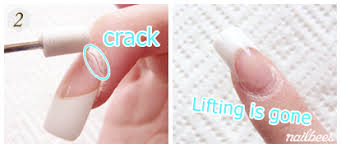 The lifting can be removed and the exposed natural nail will be covered with fresh acrylics. Acrylic Fill In Nailbees