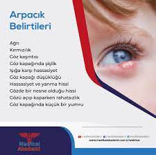 Gozde Arpacik Belirtileri 2020 Gozler Doktorlar Ordu