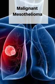 Chest pain and fatigue after exertion are common among pericardial . Pin On Legal And General