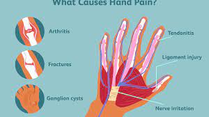 Diagram of tendons in hand stock illustration. Hand Pain Causes And Treatments