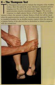 The lateral malleolus provides key stability against excessive eversion of the ankle and foot. Office Management Of Acute Ankle Injuries Part 1 Consultant360