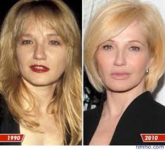 Ellen Barkin Ellen Barkin Celebrity Plastic Surgery Plastic Surgery