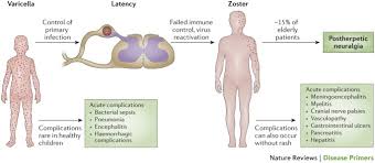 Image result for Varicella zoster on human skin