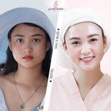 Giới thiệu 10 thẩm mỹ viện uy tín hàng đầu Việt Nam được yêu thíchChụp hình  cưới, ảnh gia đình, ảnh nghệ thuật