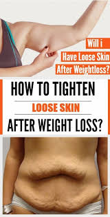 Get Rid Of Saggy Stomach Skin In 2020 Tighten Stomach Tighten Loose Skin Loose Skin
