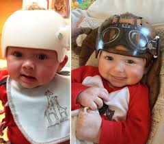 Baby Helmet Painting Lazardo Art 120 Baby Helmet Children S Medical Helmet