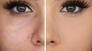 hide large pores make pores disappear