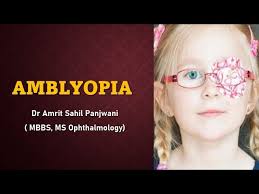 Image result for Amblyopia