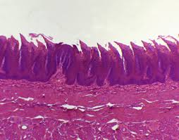 Image result for Filiform Papillae