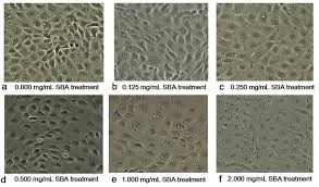 The toll business was established in newcastle, australia in 1888. A F Effect Of Soybean Agglutinin Sba On The Morphology Of Ipec J2 Download Scientific Diagram