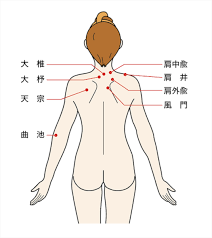 Dec 14, 2015 · 背中が痛いというと…肩こりかな？ 背中の痛みの原因として、まず思い浮かぶであろうものが肩こりです。 首筋・首の付け根・肩・背中にかけて張る、凝る、痛みを感じるといった症状がでます。 èä¸­ã®ã³ãªã«é¼ãå¹ã ã¡ã«ããºã ã¨æ³¨æç¹ã'å¾¹åºè§£èª¬ é¼ç¸é¢äºç´ æ¤ç´¢ãµã¤ã å¥åº·ã«ã¯ã